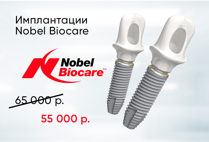 Специальное предложение по имплантации Nobel Biocare  55000 руб вместо 65000 руб